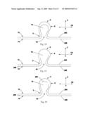 TUFTED FIBROUS WEB diagram and image