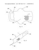 TUFTED FIBROUS WEB diagram and image