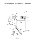 System for tissue electroporation and method for use thereof diagram and image