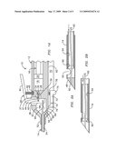 Retractable Tip For Vitrectomy tool diagram and image