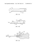 Retractable Tip For Vitrectomy tool diagram and image