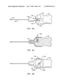 Retractable Tip For Vitrectomy tool diagram and image