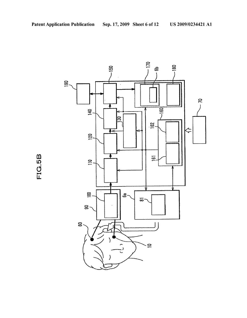 Monitoring electrode for monitoring dorsal cochlear nucleus action potentials and monitoring device for monitoring dorsal cochlear nucleus action potentials - diagram, schematic, and image 07