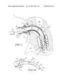 Valved Fenestrated Tracheotomy Tube Having Inner and Outer Cannulae with Pressure Relief diagram and image