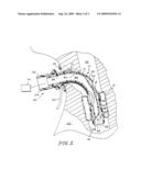 Valved Fenestrated Tracheotomy Tube Having Inner and Outer Cannulae with Pressure Relief diagram and image