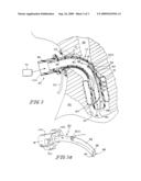 Valved Fenestrated Tracheotomy Tube Having Inner and Outer Cannulae with Pressure Relief diagram and image