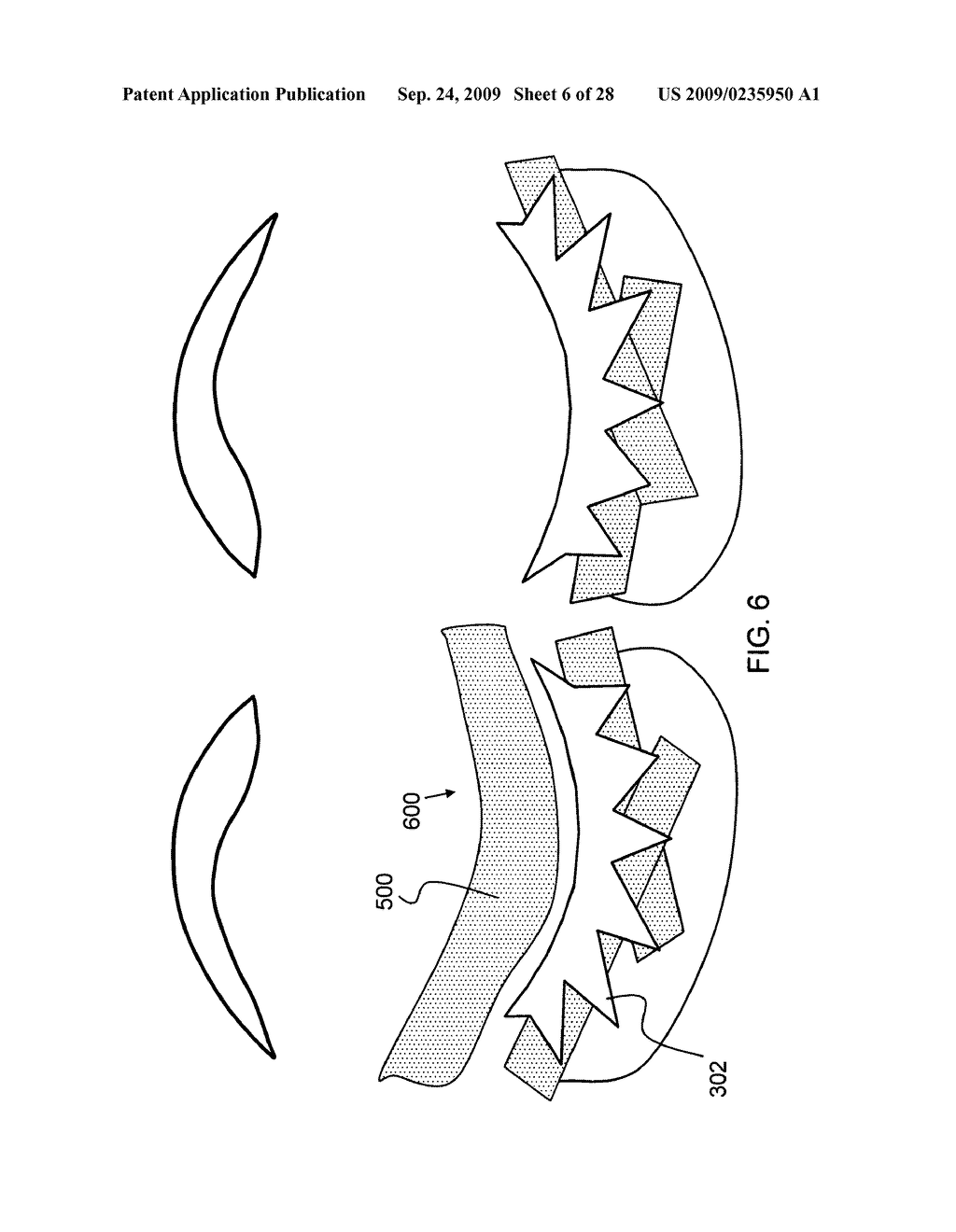 Eyelash extensions and method for applying eyelash extensions - diagram, schematic, and image 07