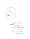 SCREEN AND METHOD FOR SCREENING PULP diagram and image