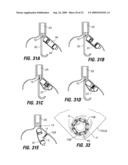 ENDOSCOPIC STAPLING DEVICES AND METHODS diagram and image