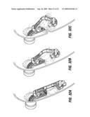 ENDOSCOPIC STAPLING DEVICES AND METHODS diagram and image