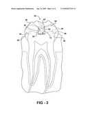 TOOTH LOCATED GPS PERSON TRACKING AND LOCATION METHOD AND APPARATUS diagram and image