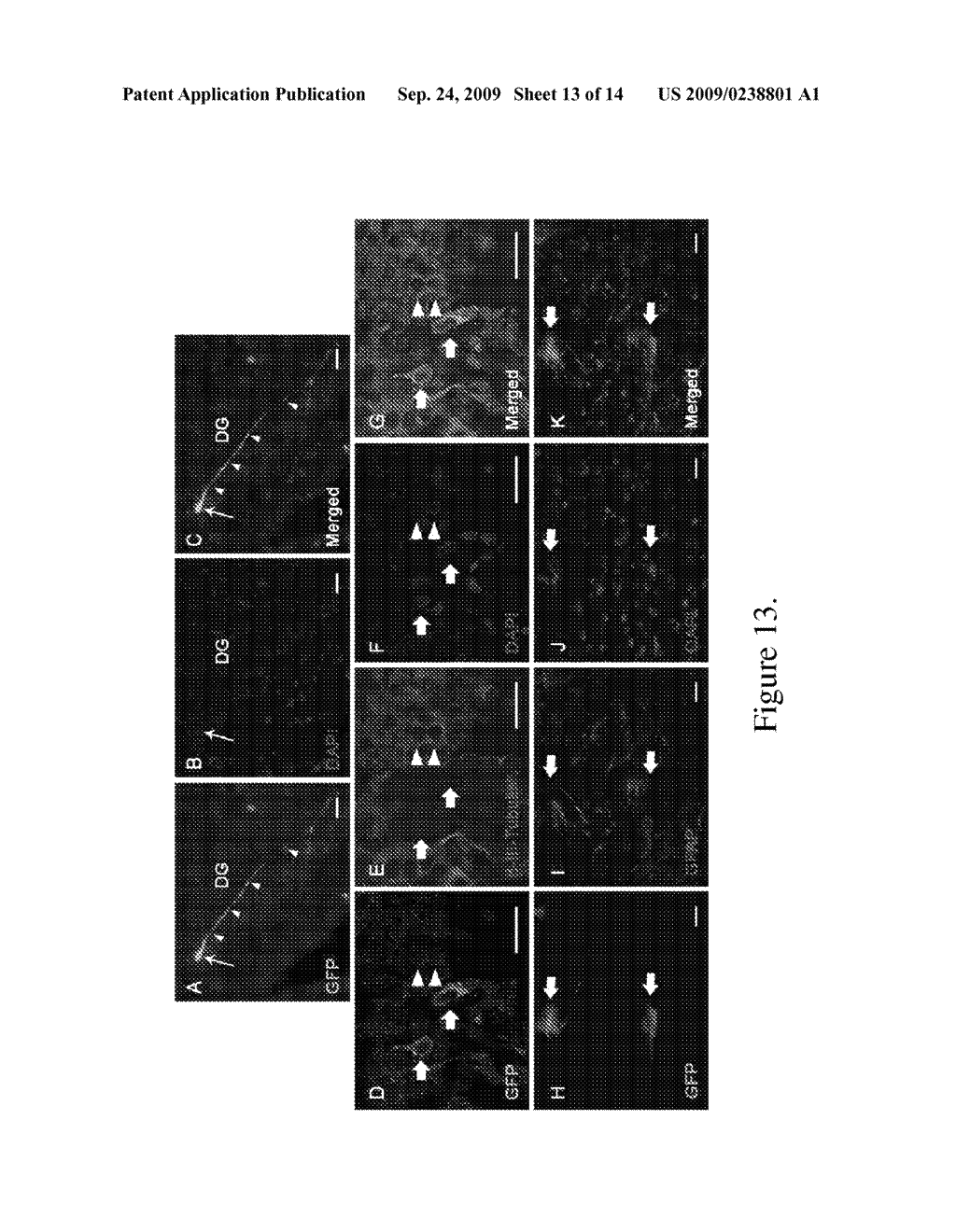 AMNION-DERIVED STEM CELLS AND USES THEREOF - diagram, schematic, and image 14