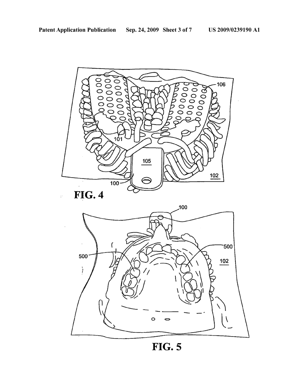 Custom fit dental tray and method for making same - diagram, schematic, and image 04