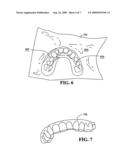 Custom fit dental tray and method for making same diagram and image