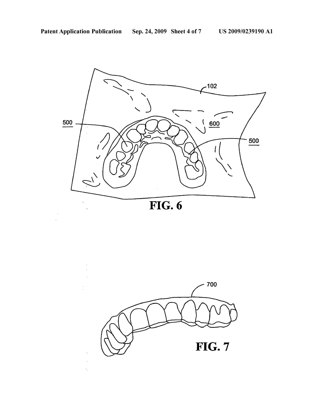 Custom fit dental tray and method for making same - diagram, schematic, and image 05