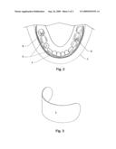 Teeth protection device diagram and image