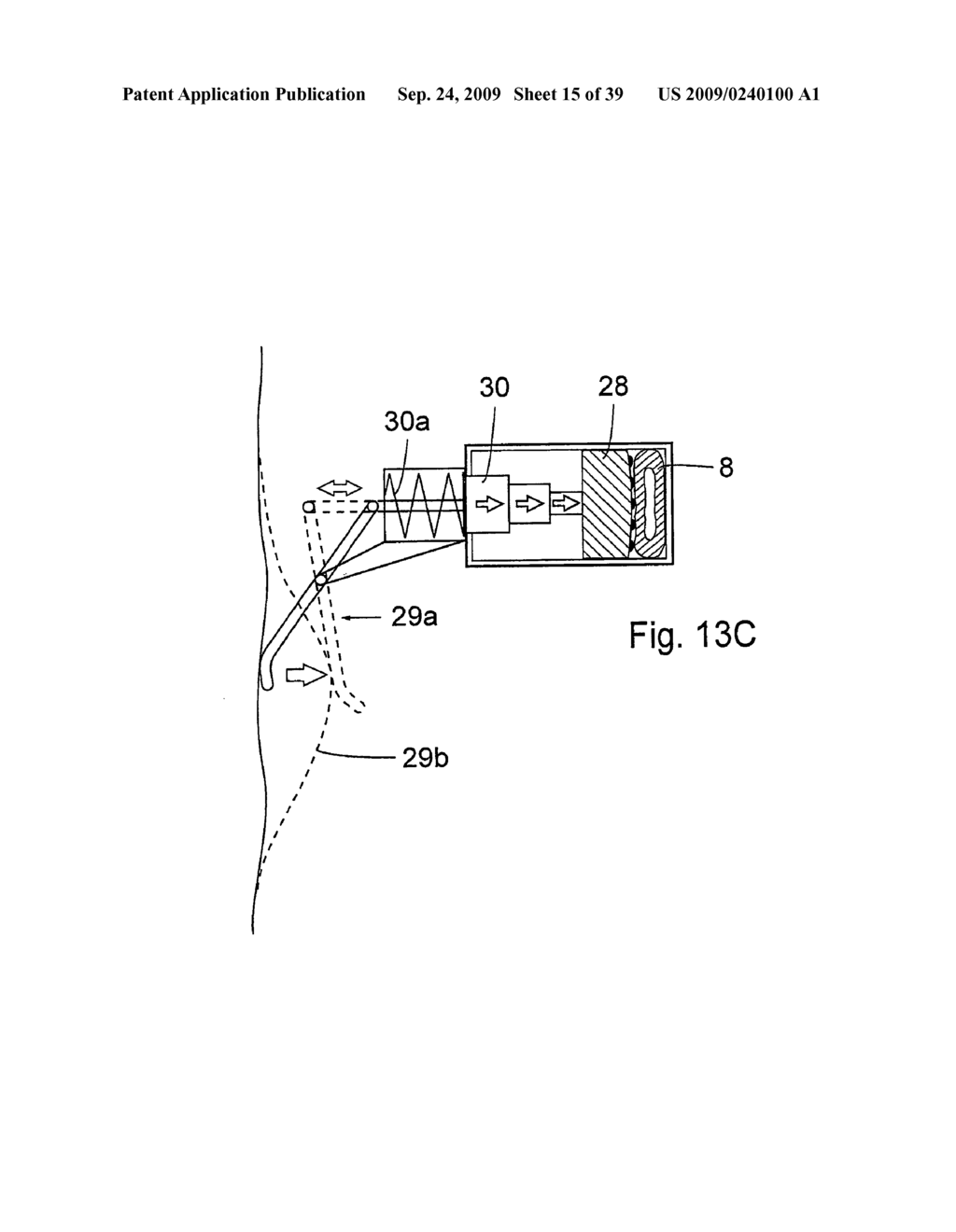 Method for controlling flow of intestinal contents in a patient's intestines - diagram, schematic, and image 16