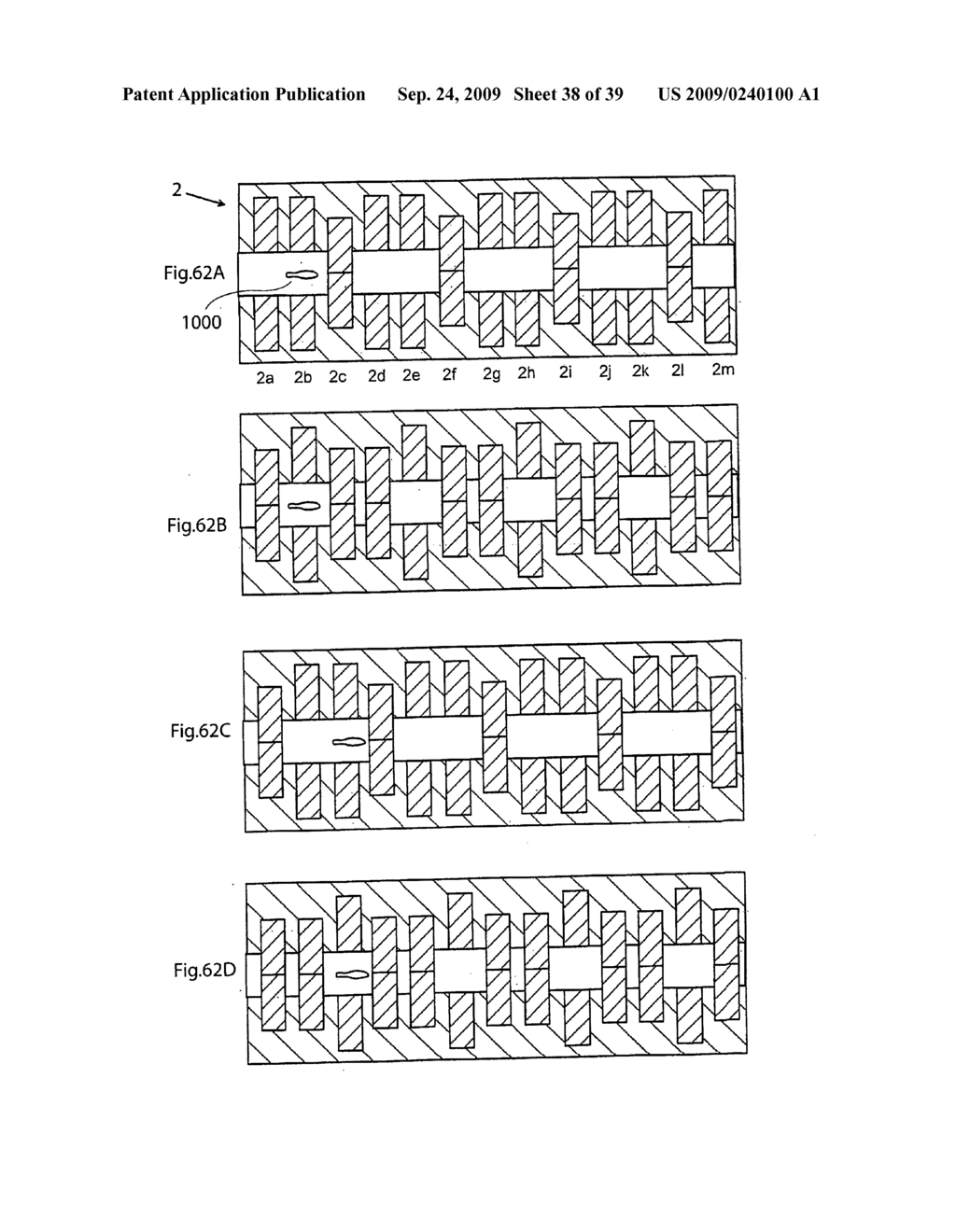 Method for controlling flow of intestinal contents in a patient's intestines - diagram, schematic, and image 39