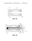 Endoscope With a Stimulating Electrode For Peripheral Nerve Blocks Under Direct Vision diagram and image