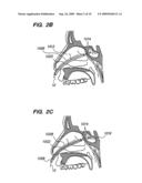 Methods and Devices for Facilitating Visualization In a Surgical Environment diagram and image