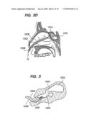 Methods and Devices for Facilitating Visualization In a Surgical Environment diagram and image