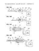 Methods and Devices for Facilitating Visualization In a Surgical Environment diagram and image