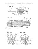 Methods and Devices for Facilitating Visualization In a Surgical Environment diagram and image