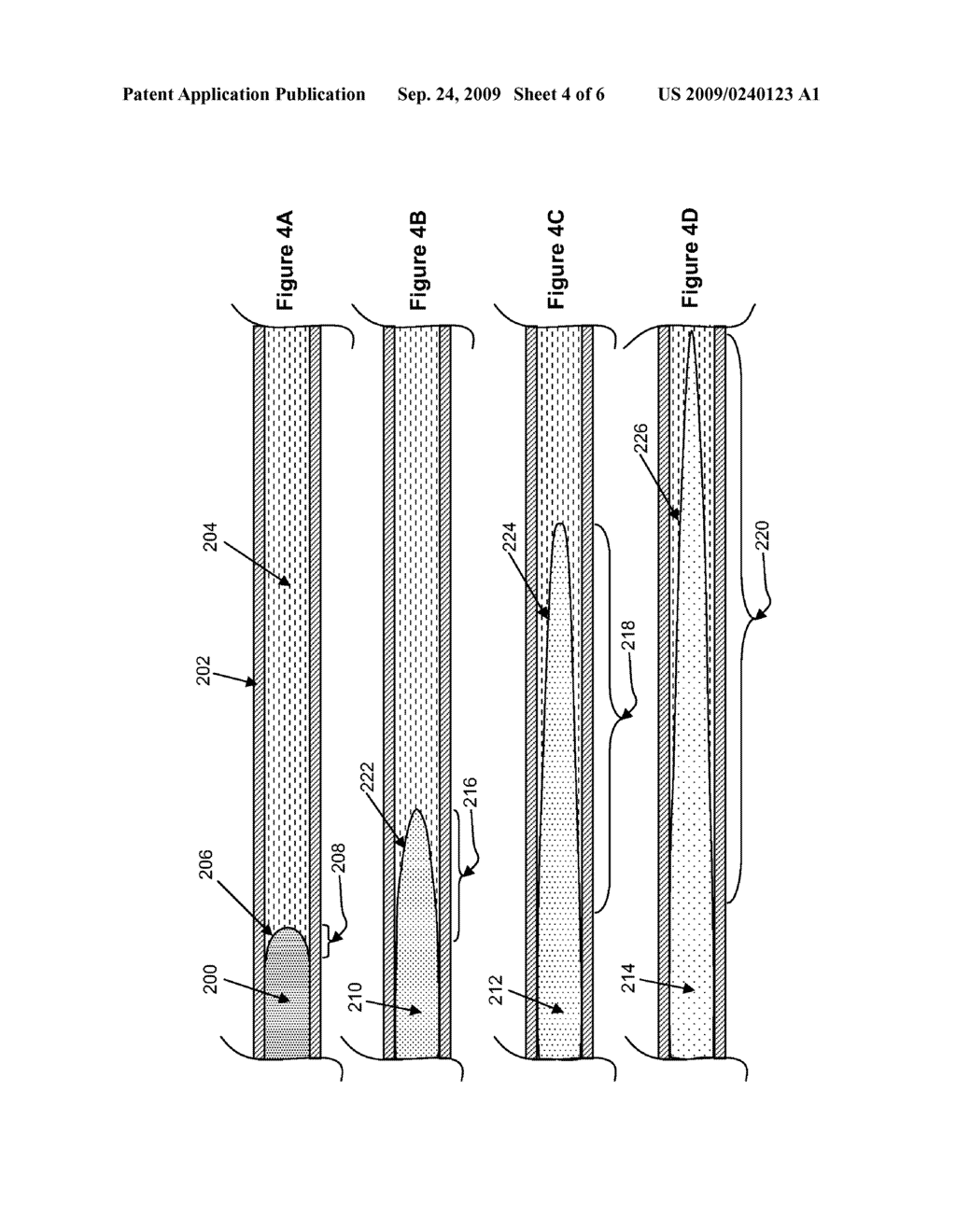 DETERMINING RELATIVE BLOOD HEMATOCRIT LEVEL USING AN AUTOMATED INTEGRATED FLUID DELIVERY AND BLOOD ACCESS DEVICE - diagram, schematic, and image 05