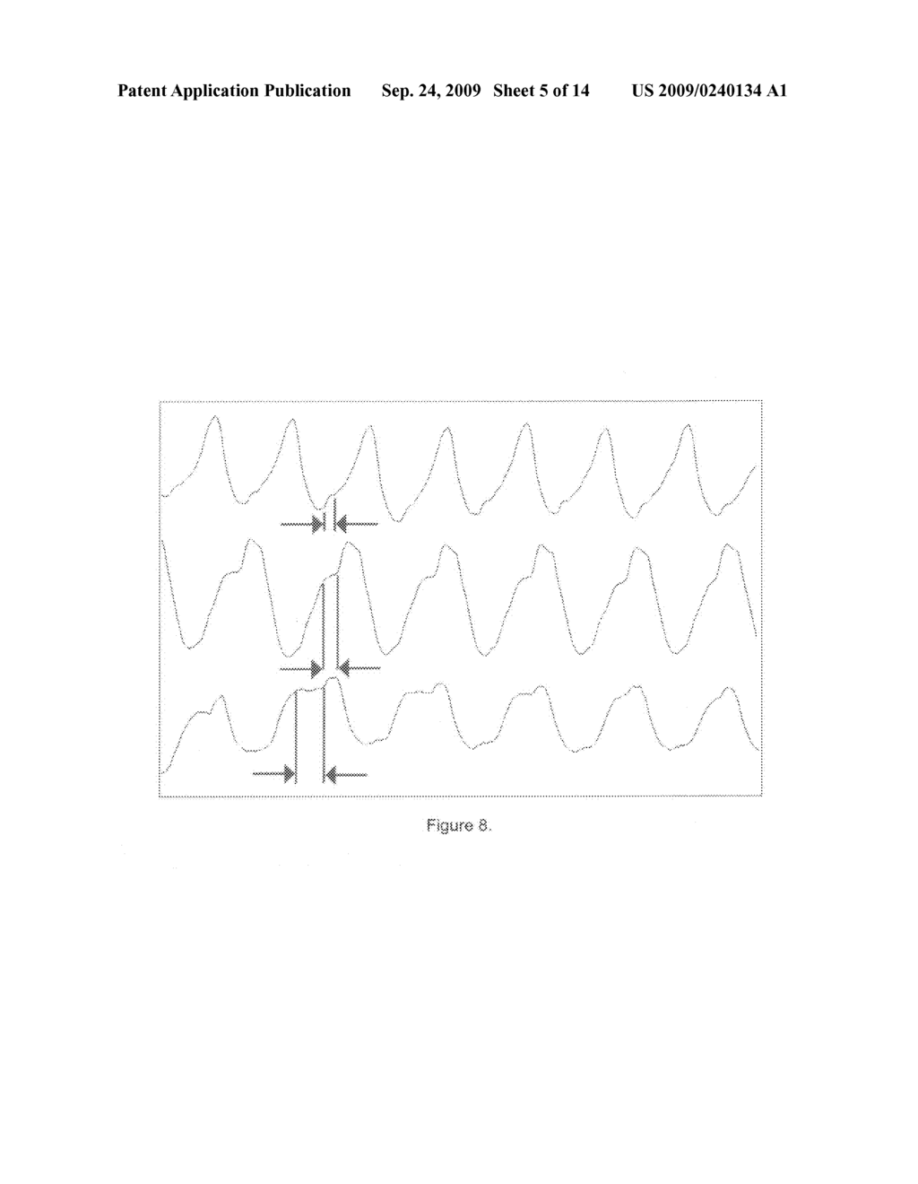 Method of processing thoracic reflected radio interrogation signals - diagram, schematic, and image 06