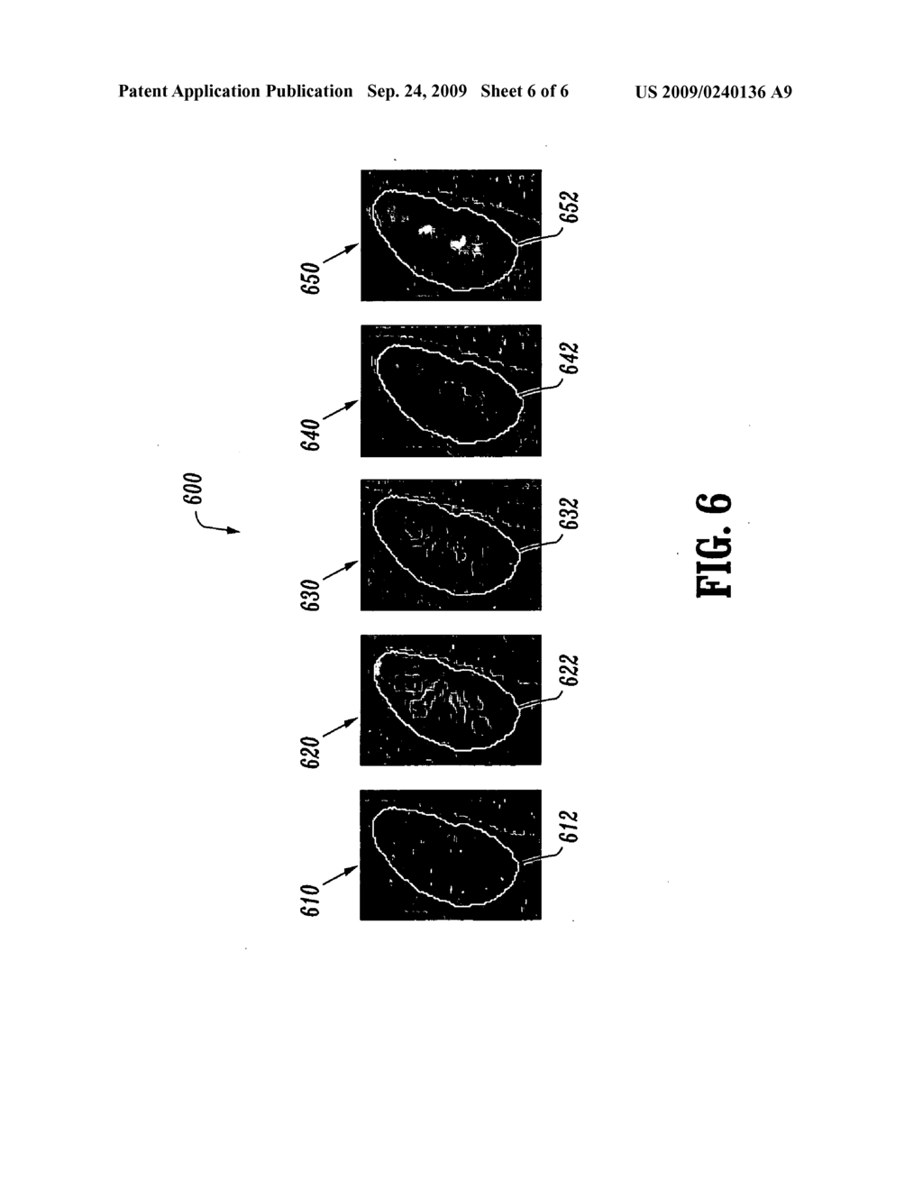 Contrast-invariant registration of cardiac and renal magnetic resonance perfusion images - diagram, schematic, and image 07