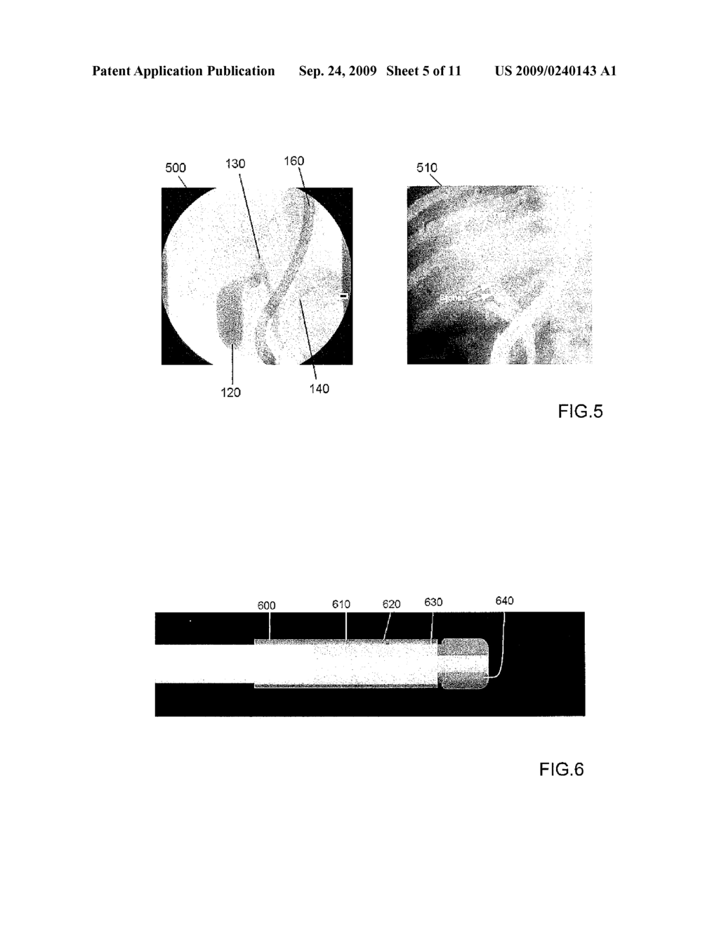 METHOD AND AN OPTICAL PROBE FOR IN VIVO IMAGING OF A MUCOSA IN A BILIARY OR PANCREATIC SYSTEM AND A METHOD FOR SELECTIVELY OPERATING A TISSUE SAMPLING OF A MUCOSA IN A BILIARY OR PANCREATIC SYSTEM - diagram, schematic, and image 06