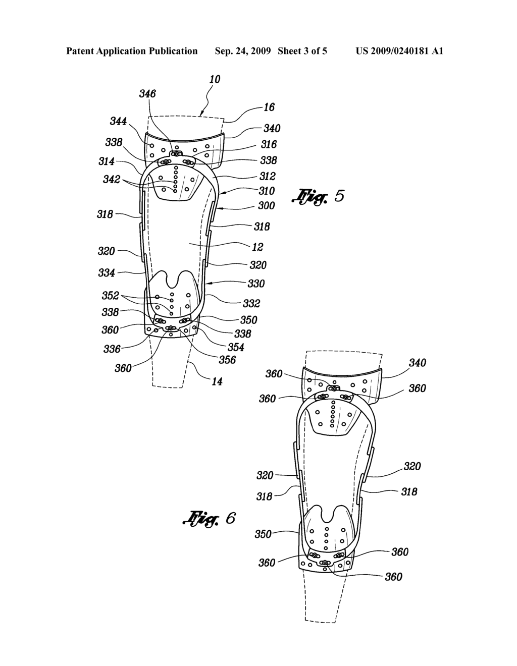 Adjustable orthotic device - diagram, schematic, and image 04