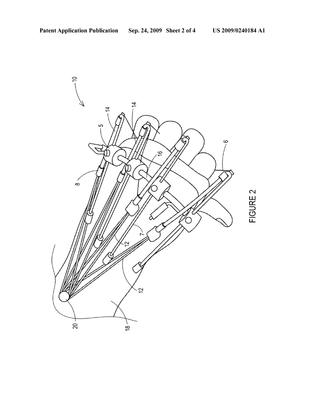 Interchangeable Range Of Motion Stop - diagram, schematic, and image 03