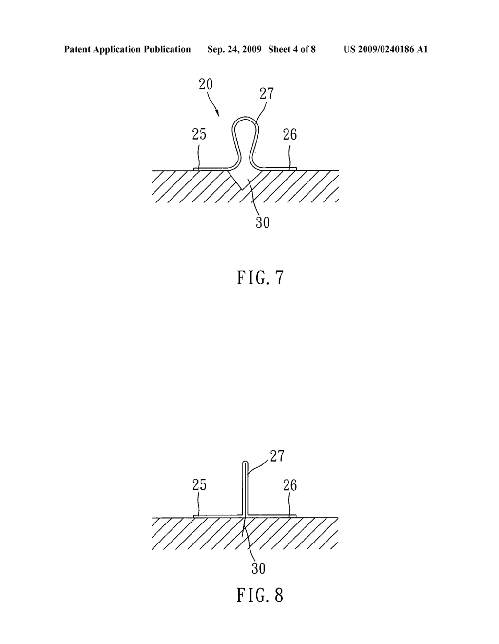 Wound rebuilding band-aid without need of stitches - diagram, schematic, and image 05