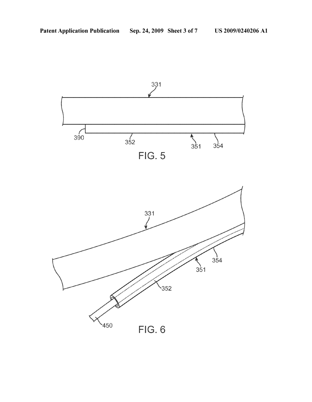 Rapid Exchange Catheter With Tear Resistant Guidewire Shaft - diagram, schematic, and image 04