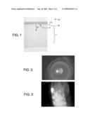 NOVEL MICROFABRICATED INSTRUMENTS AND METHODS TO TREAT RECURRENT CORNEAL EROSION diagram and image