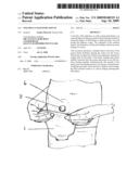 One-piece colostomy pouch diagram and image