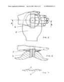 One-piece colostomy pouch diagram and image