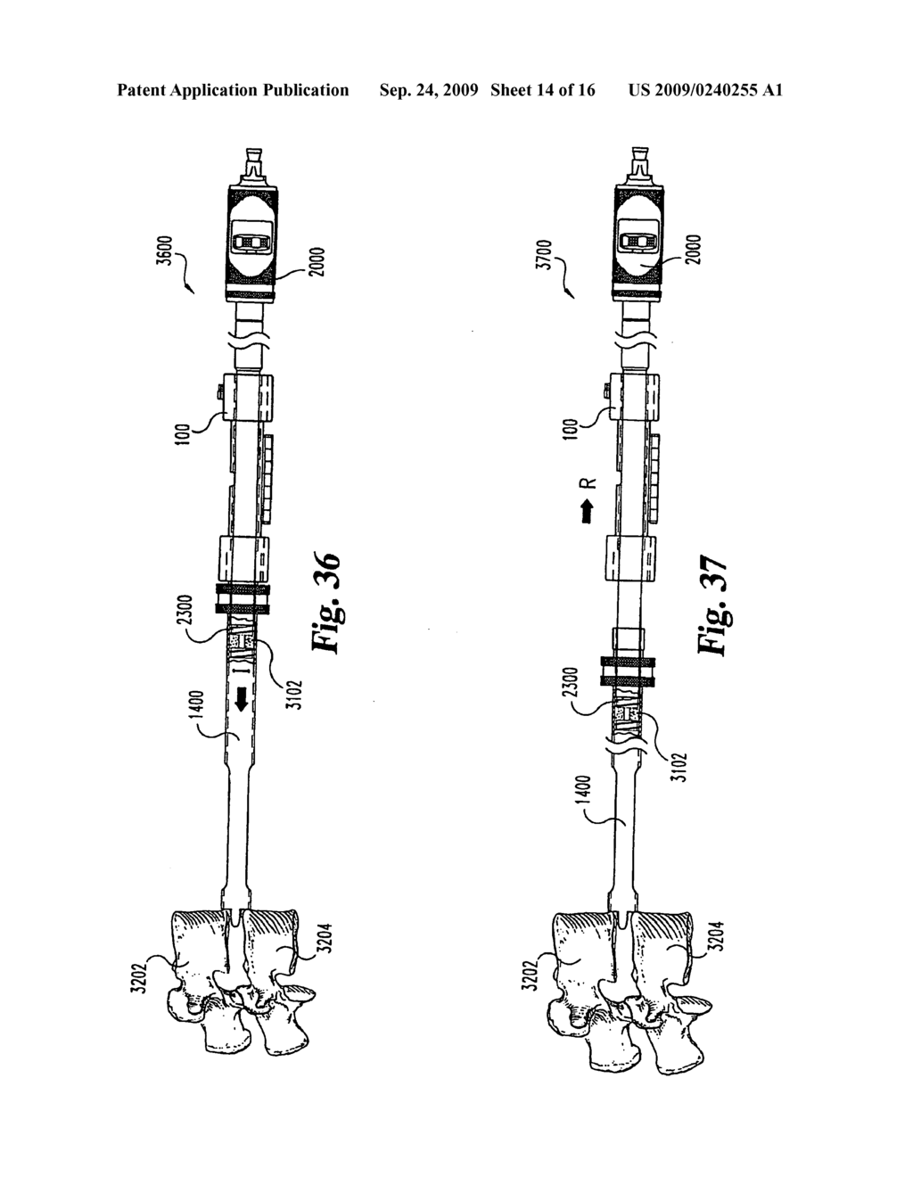 Osteogenic packing device and method - diagram, schematic, and image 15