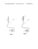 DETACHABLE HANDLE FOR IMPLANTABLE ELECTRICAL STIMULATION SYSTEMS AND METHODS OF MAKING AND USING diagram and image