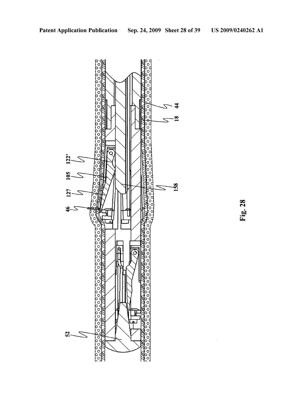 Device for affixing prosthesis to a vessel - diagram, schematic, and image 29