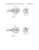 Surgical actuator and locking system diagram and image