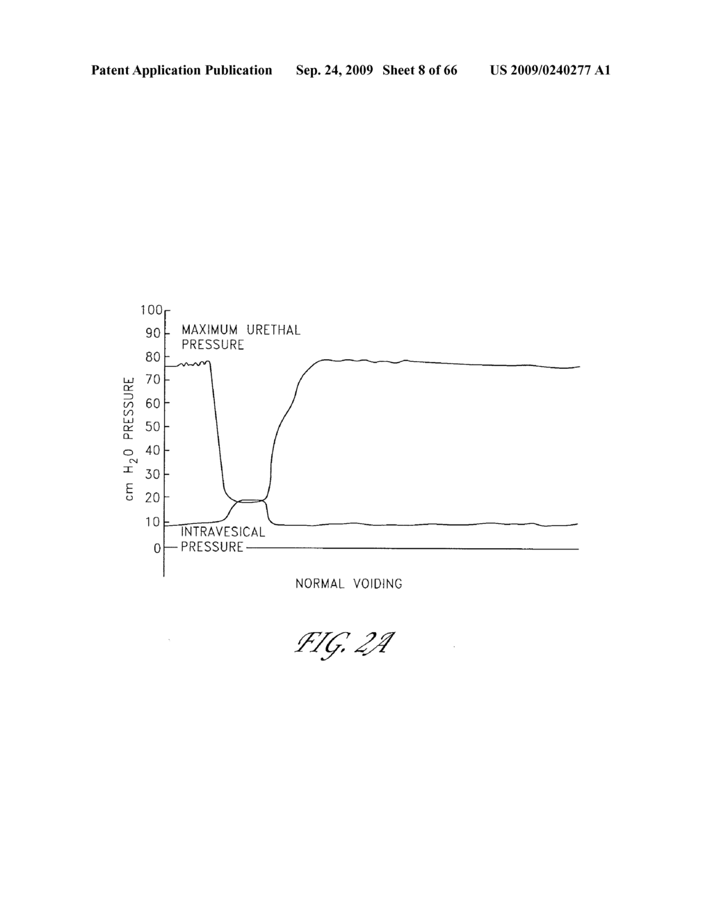 PRESSURE ATTENUATION DEVICE - diagram, schematic, and image 09