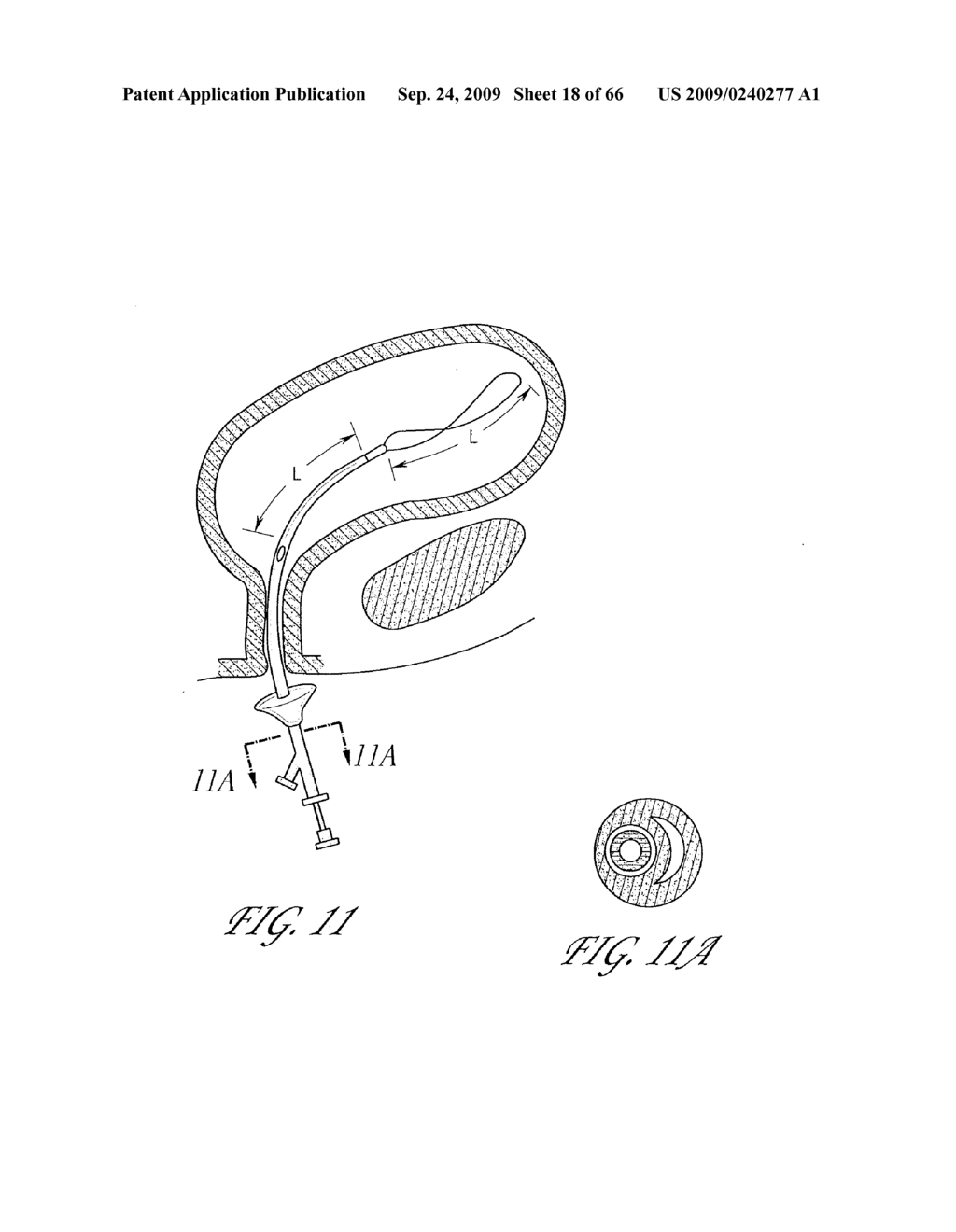 PRESSURE ATTENUATION DEVICE - diagram, schematic, and image 19