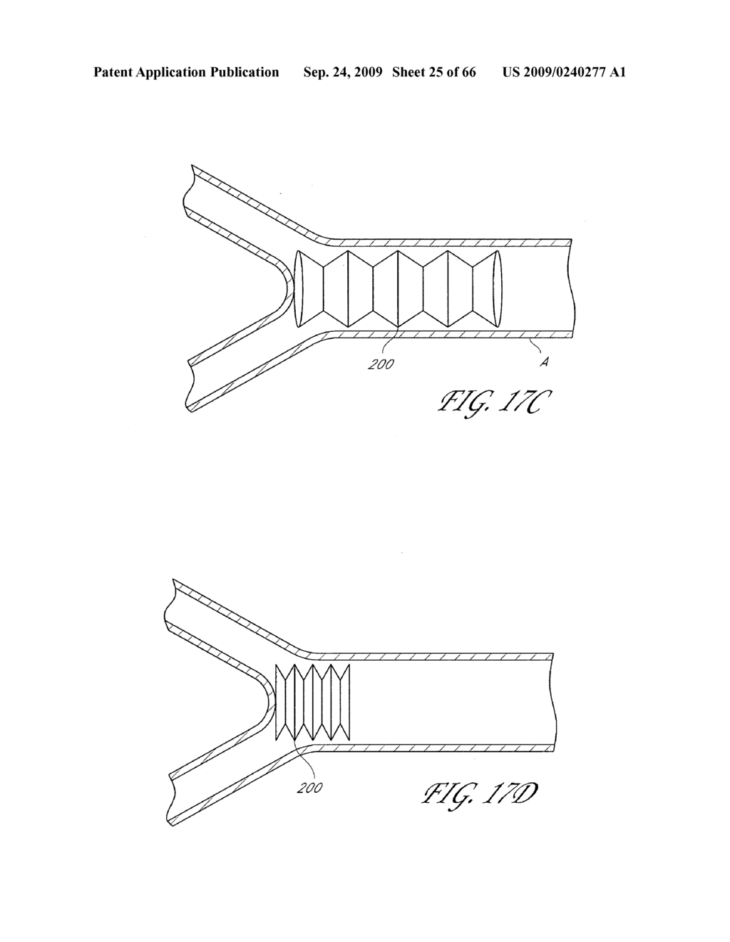 PRESSURE ATTENUATION DEVICE - diagram, schematic, and image 26