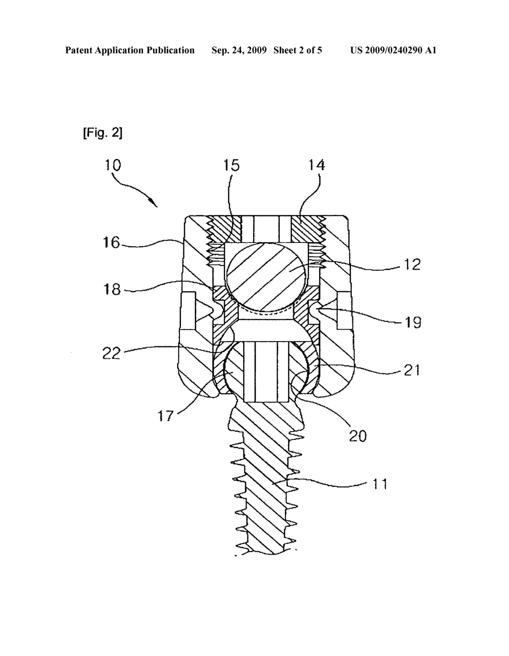 Buffer type vertebral pedicle screw - diagram, schematic, and image 03