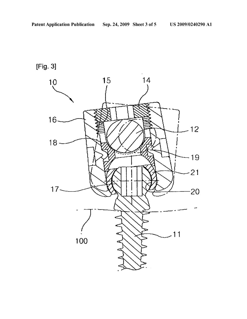Buffer type vertebral pedicle screw - diagram, schematic, and image 04
