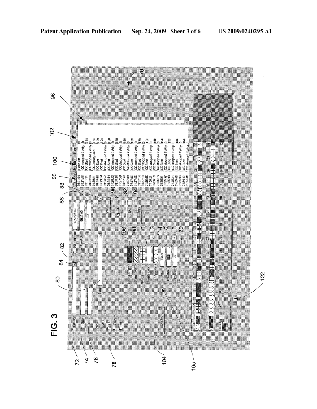 CPR ANALYSIS SYSTEM AND METHOD - diagram, schematic, and image 04