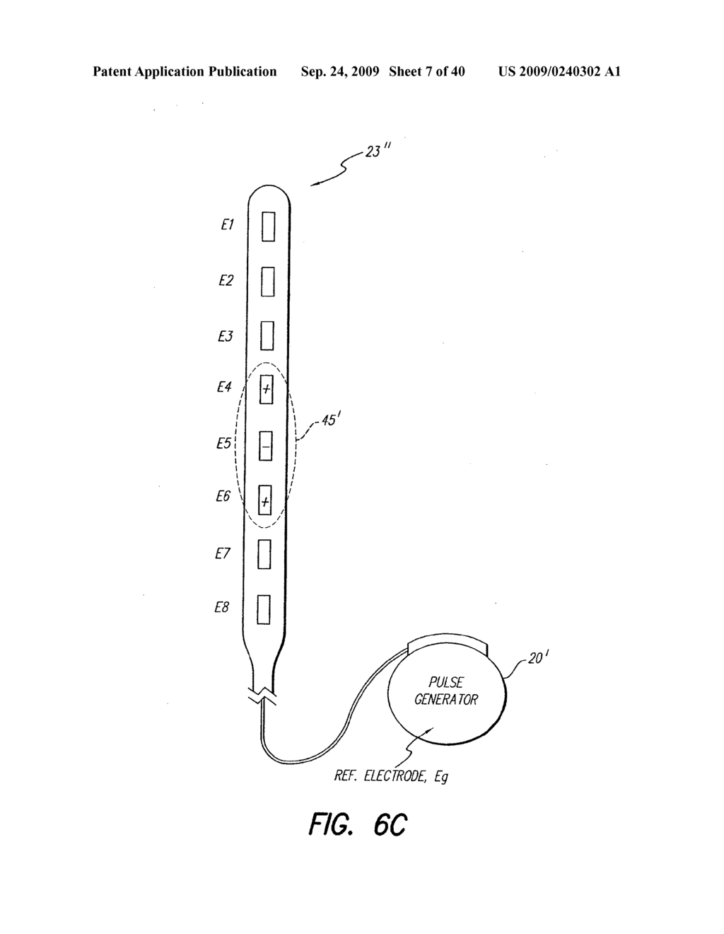 IMPLANTABLE PULSE GENERATOR HAVING CURRENT STEERING MEANS - diagram, schematic, and image 08