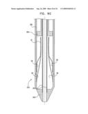 VALVE SUTURING AND IMPLANTATION PROCEDURES diagram and image